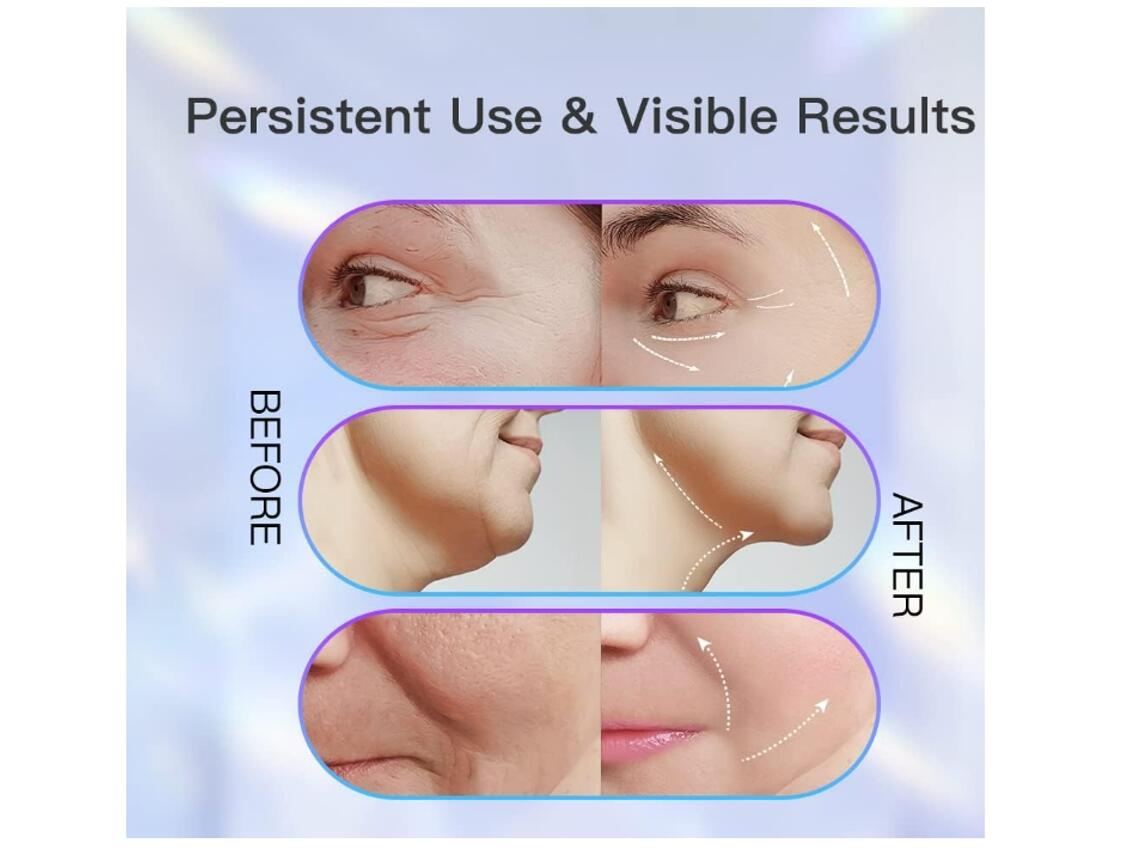 Masajeador facial lifting - Dispositivo Facial de Limpieza con 3 Luces LED